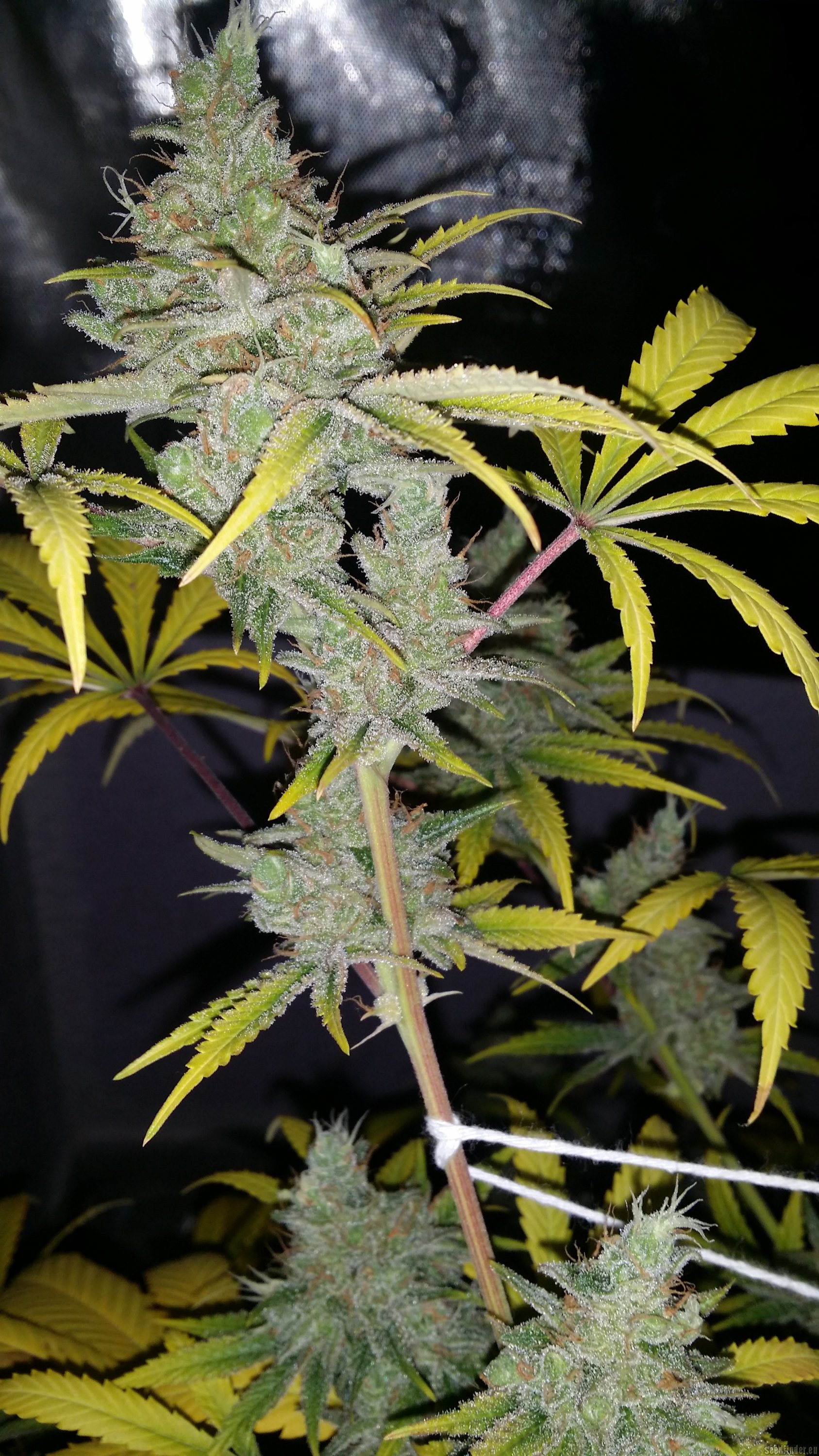 Clinical strain photo